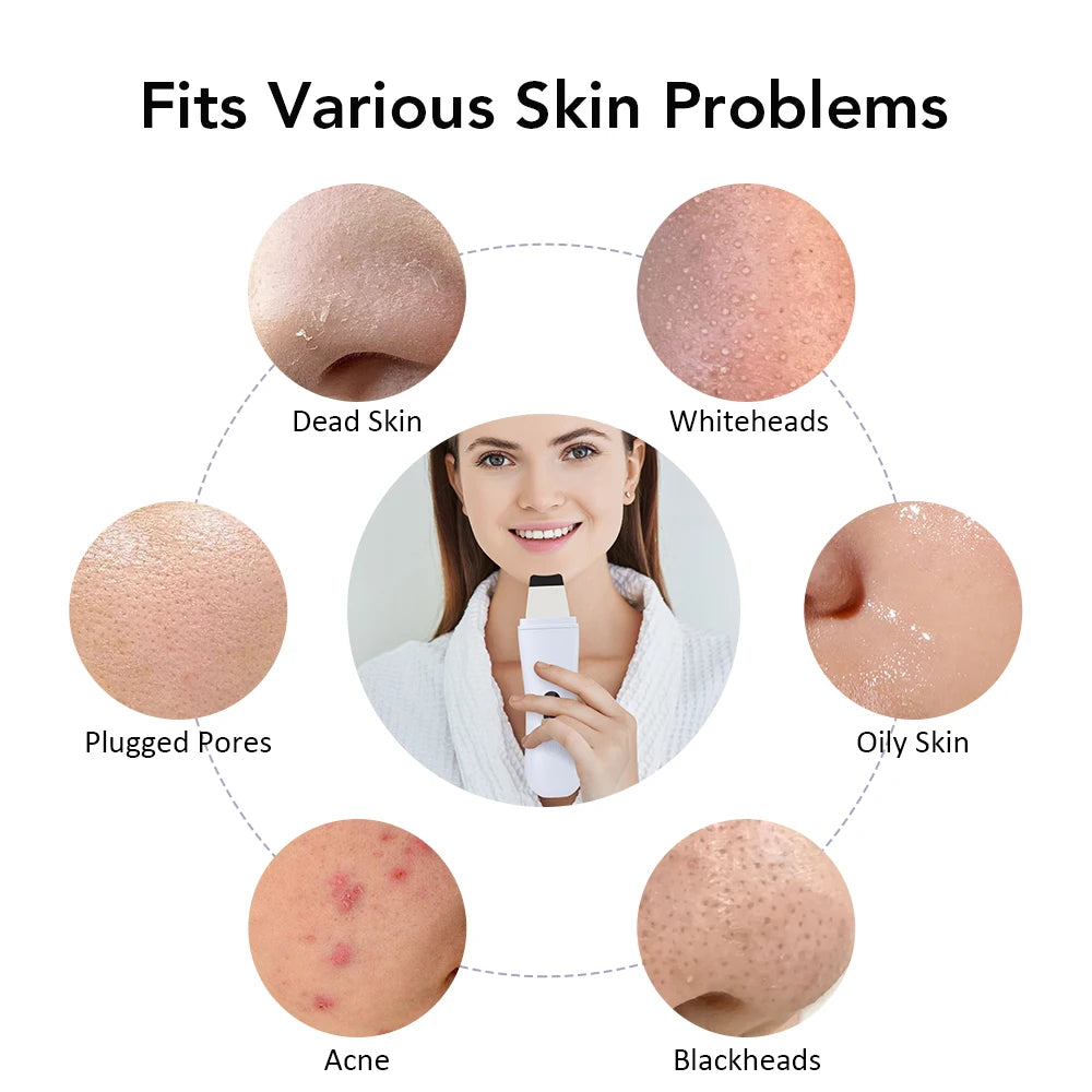Ultrasonic Skin Scrubber – 4-in-1 Deep Facial Cleansing & Skin Lifting Device